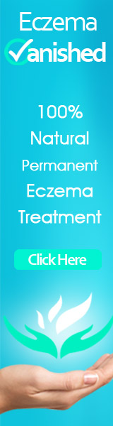 Eczema Vanished