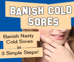 Banish Cold Sores