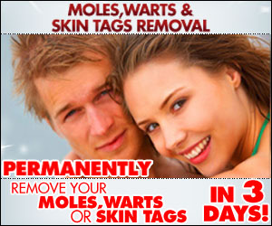 Mole and Warts Removal