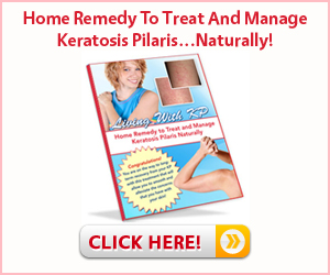 Living with Keratosis