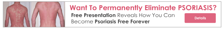 The Psoriasis Program