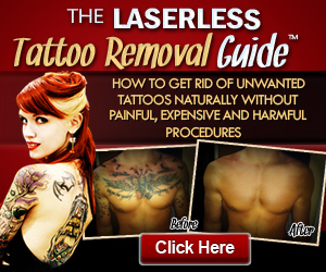 Laserless Tattoo Removal